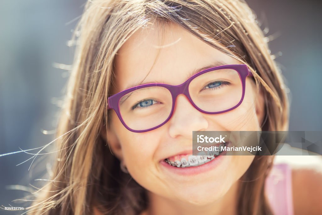 Glücklich lächelnde Mädchen mit Zahnspangen und Gläser. Junge süße kaukasische blonde Mädchen tragen Zähne Zahnspange und Brille - Lizenzfrei Zahnspange Stock-Foto