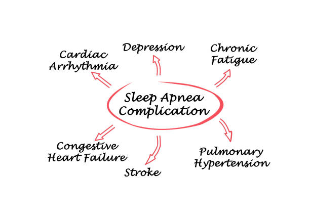 istock Complication Of Sleep Apnea 825985954
