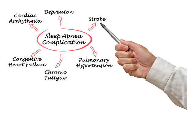 istock Complication Of Sleep Apnea 825989750