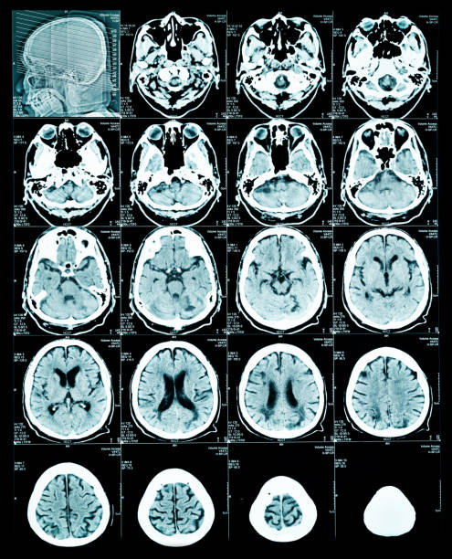 MRI scan image of brain MRI scan image of brain for diagnosis mri scanner photos stock pictures, royalty-free photos & images