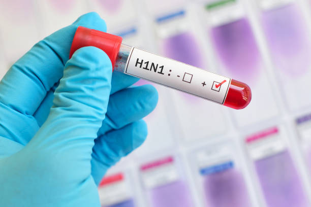 H1N1 influenza positive stock photo