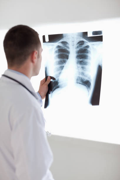 istock Doctor holding xray against light 826567730