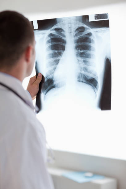 istock Close up of doctor using light to check xray 826567776