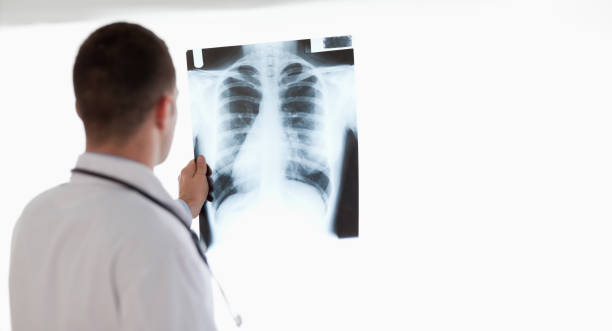 istock Doctor having a close look at xray while holding it against light 826567804