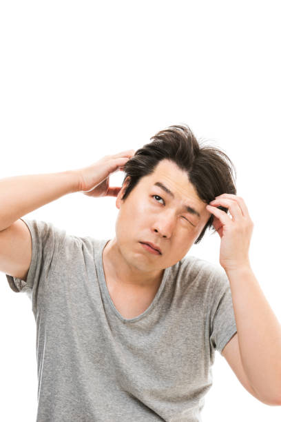 istock Men who are concerned about hair loss 826766908