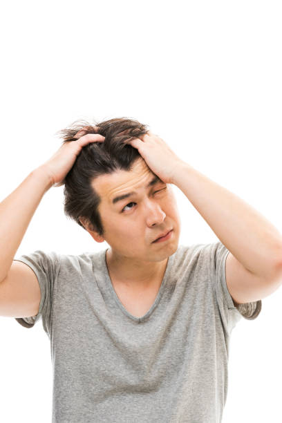 istock Men who are concerned about hair loss 826767434