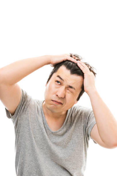 istock Men who are concerned about hair loss 826767780