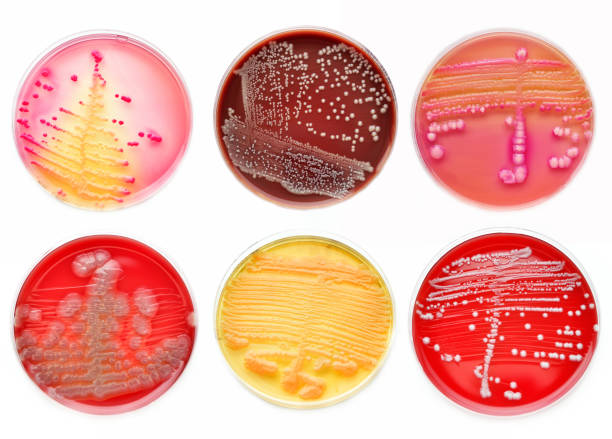 박테리아 문화 - petri dish 이미지 뉴스 사진 이미지