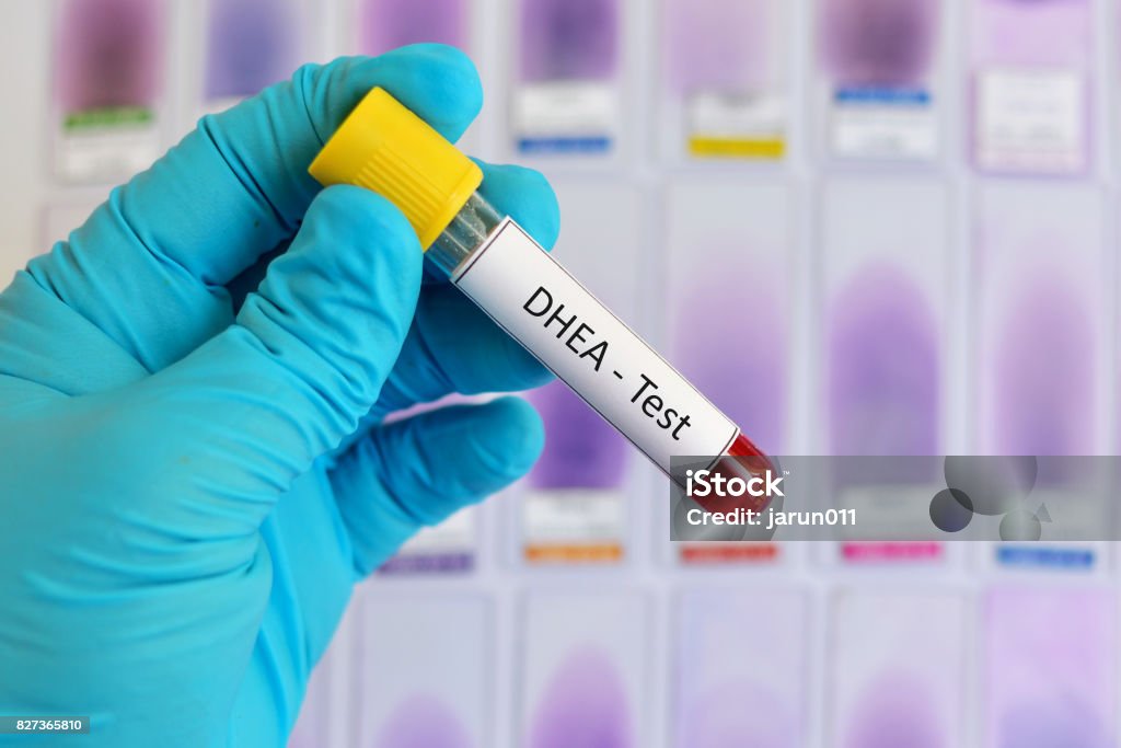 Dhea Test Stock Photo - Download Image Now - Analyzing, Blood ...