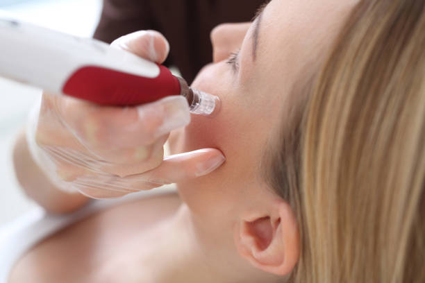 istock Beautician performs a needle mesotherapy treatment on a woman's face 827663656