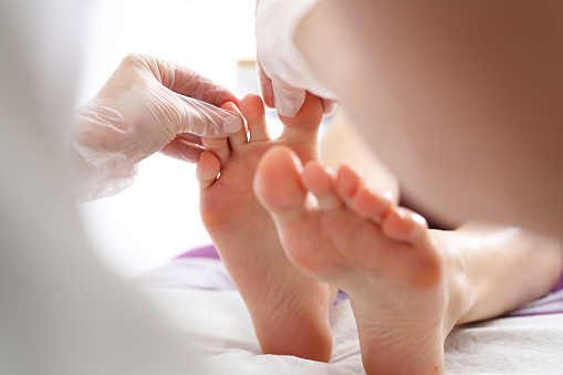 Hongo del dedo del pie y uñas. Mujer en un dermatólogo. photo