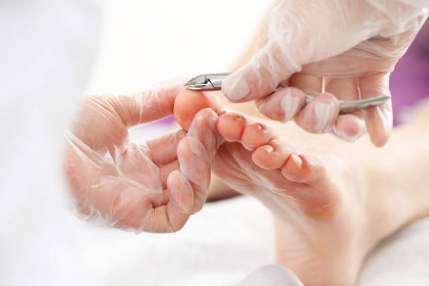 페디큐어, 절단 스킨 - pedicure podiatry beauty nail clipper 뉴스 사진 이미지