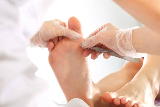 podología. eliminación de las huellas de los pies. - medical supplies scalpel surgery equipment fotografías e imágenes de stock