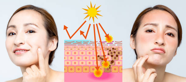 woman using sunscreen and woman getting sunburned. before after image. woman using sunscreen and woman getting sunburned. before after image. melanin photos stock pictures, royalty-free photos & images