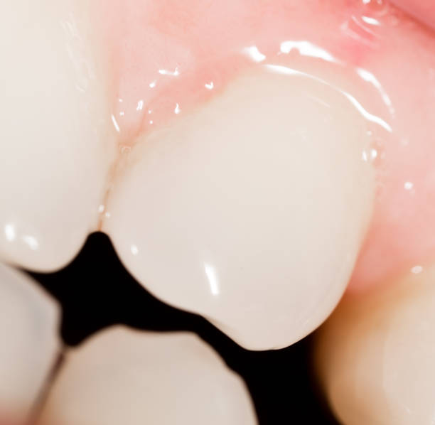 istock Teeth in the mouth. macro 828490160