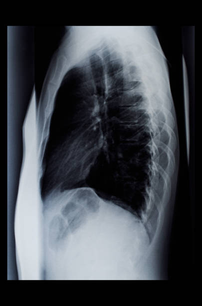 istock Fluorography of the spine 828553826