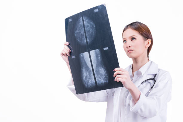 ärztin, die überprüfung der mammographie röntgenfilm - mammogram mri scan breast breast examination stock-fotos und bilder