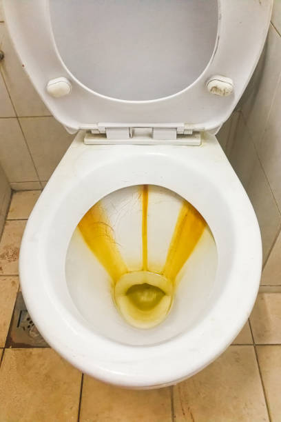 istock Dirty toilet bowl with limescale stain deposits 831688448