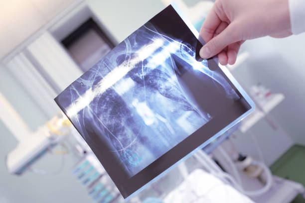 istock X-ray of patient in doctors hand 831805686