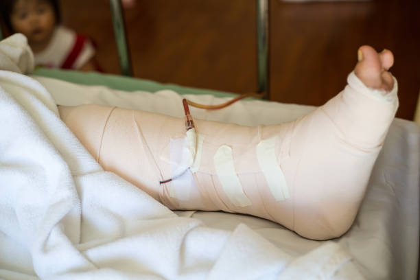 senior adult leg injury sleeping - physical injury men orthopedic equipment isolated on white imagens e fotografias de stock
