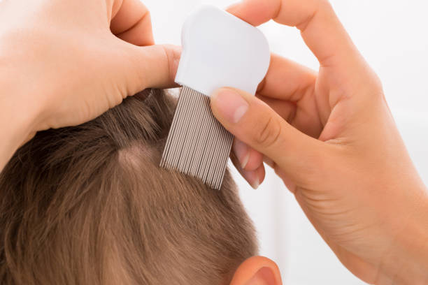 Doctor Doing Treatment On Boy's Hair