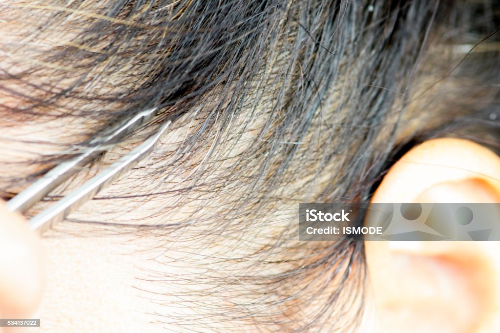 Plucking Gray Hair From Women Head With Tweezer Stock Photo - Download  Image Now - Gray Hair, Pulling, Active Seniors - iStock