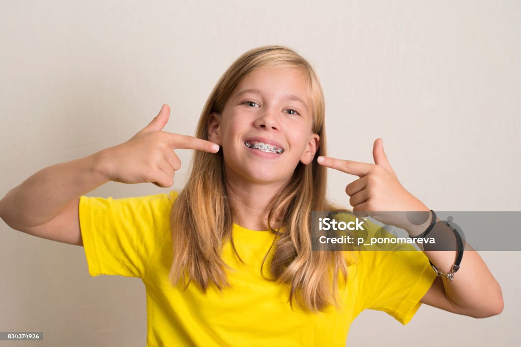 Happy teen girl in yellow t-shirt showing her dental brace. Dental Braces Stock Photo