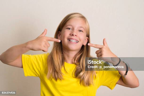 Happy Teen Girl In Yellow Tshirt Showing Her Dental Brace Stock Photo - Download Image Now