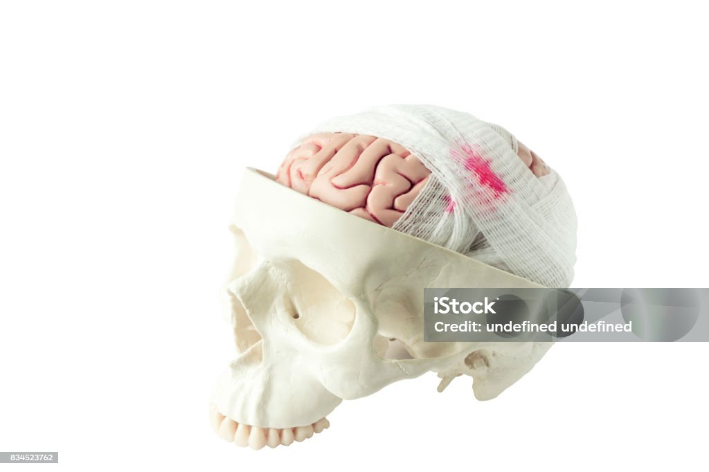 Brain model with gauze wrapping Human brain model with gauze wrapping demonstrating brain injury isolated on the white background Anatomical Model Stock Photo