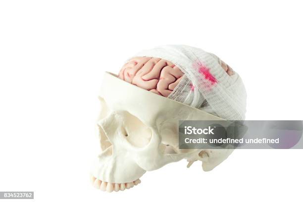 Brain Model With Gauze Wrapping Stock Photo - Download Image Now - Anatomical Model, Anatomist, Anatomy