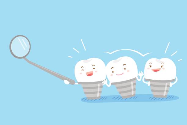 cartoon implant tooth cartoon implant tooth on the blue background cute cartoon dental implants stock illustrations