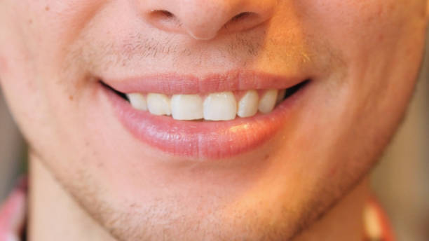 istock Close Up of Man Smiling Lips and Teeth 835864130