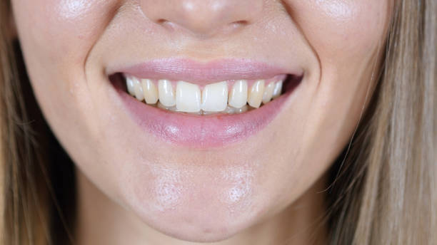 istock Close Up Of Smiling Female Lips 835905956