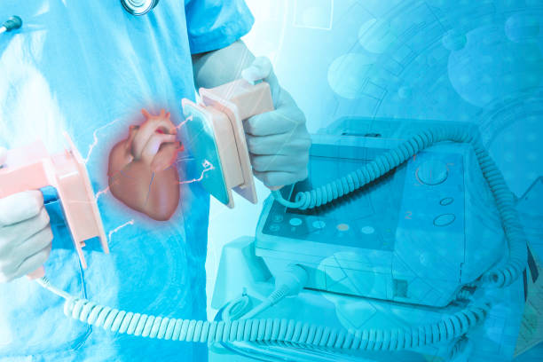 Tiêu chí lựa chọn máy sốc tim.