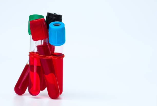 istock Blood test tube and stethoscope with syringe on white background. 836470506