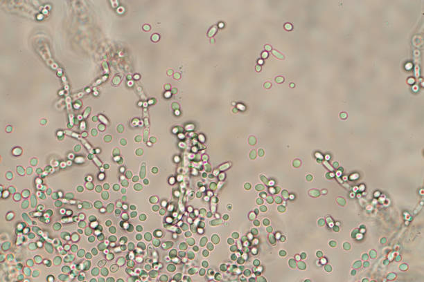 yeast under the microscope. - bacterium petri dish colony microbiology imagens e fotografias de stock