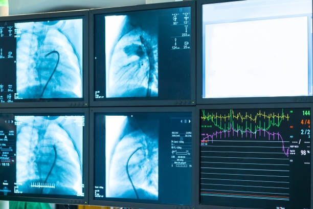 istock Xray monitor 836566878