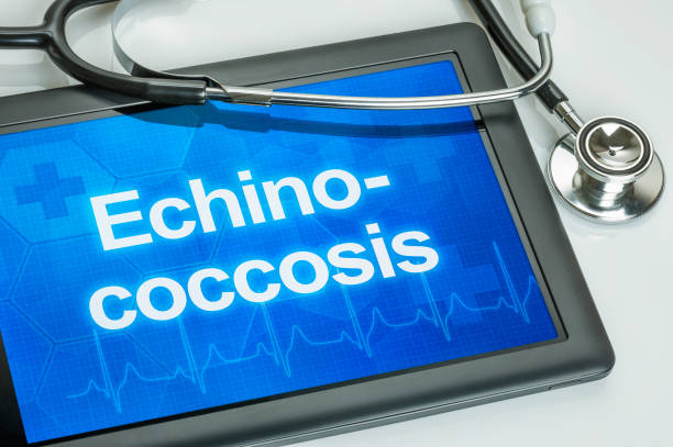 Tablet with the diagnosis echinococcosis on the display