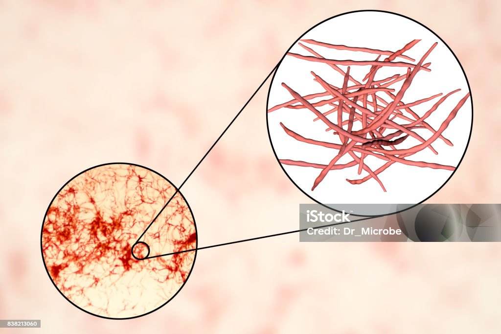 Actinomicetos, bacterias anaerobias Gram-positivas que se asemejan a hongos - Foto de stock de Actinomicete libre de derechos