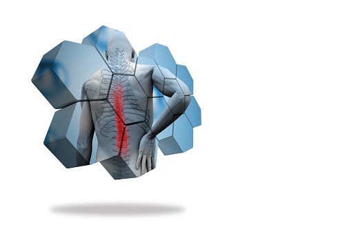 Back injury diagram on abstract screen on white background
