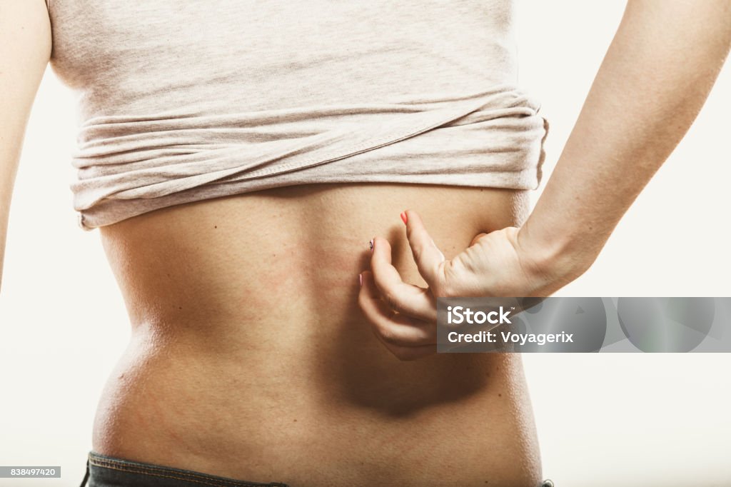 Human scratching itchy back skin. Rash. Human scratching itchy sore back skin. Allergy rash. Health problem. Adult Stock Photo