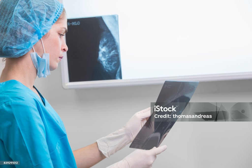woman doctor or nurse in surgery outfit is holding a mammogram in front of x-ray illuminator Mammogram Stock Photo