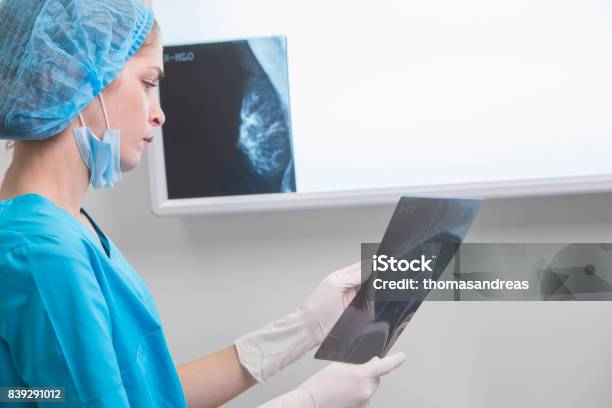 Woman Doctor Or Nurse In Surgery Outfit Is Holding A Mammogram In Front Of Xray Illuminator Stock Photo - Download Image Now