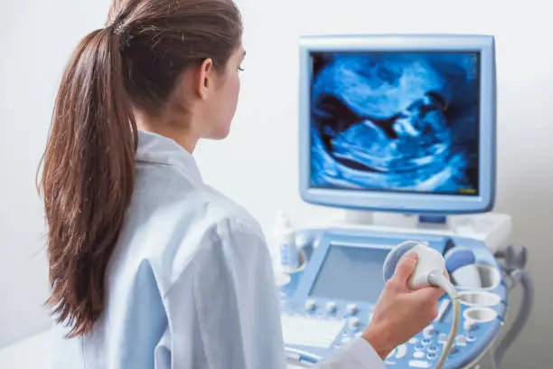 Photo of young woman doctor is viewing an ultrasound result to test for visible trisomy 21 signs