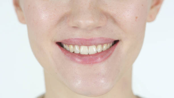 istock Close Up of Smiling Girl Lips 839818802