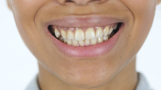istock Smiling Afro American Woman Lips 839819706