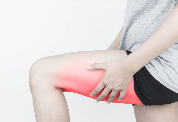 Young woman with pulled hamstring. Hamstring pain after sport playing. Young woman with pulled hamstring. Hamstring pain after sport playing. hamstring stock pictures, royalty-free photos & images