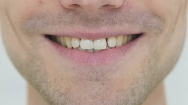 istock Smiling Man Face Close Up, Overwhelmed 840085382