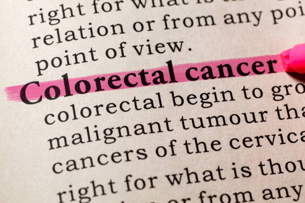 istock definition of Colorectal cancer 840227196