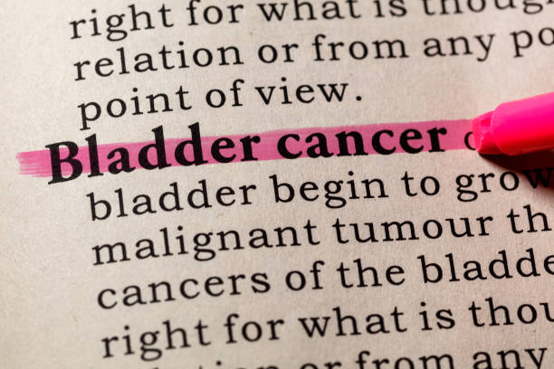 definition of  Bladder cancer Fake Dictionary, Dictionary definition of the word  Bladder cancerr. including key descriptive words. bladder cancer stock pictures, royalty-free photos & images
